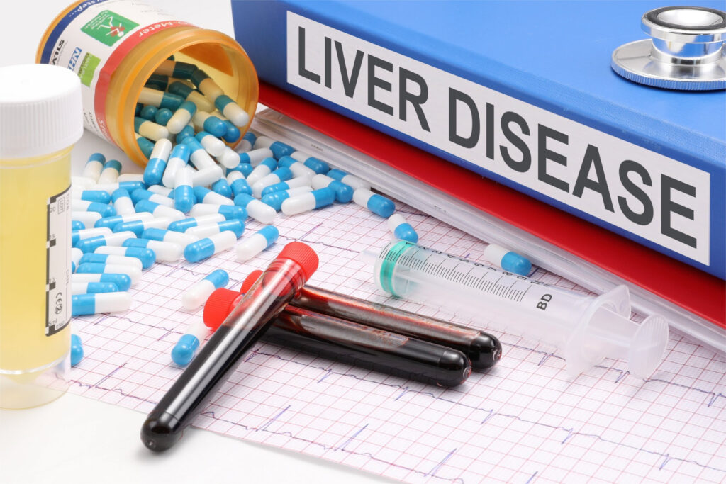 Liver Disease Symptoms: Recognizing