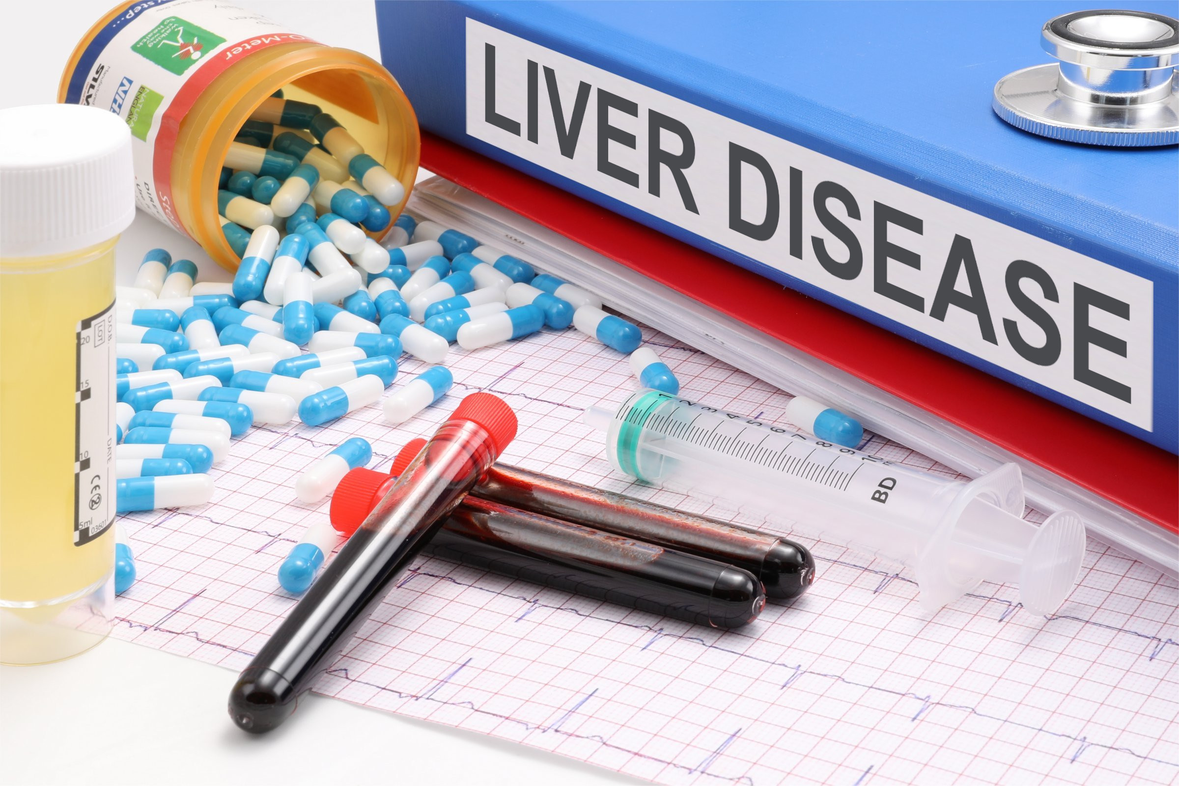 Read more about the article Liver Disease Symptoms: Recognizing