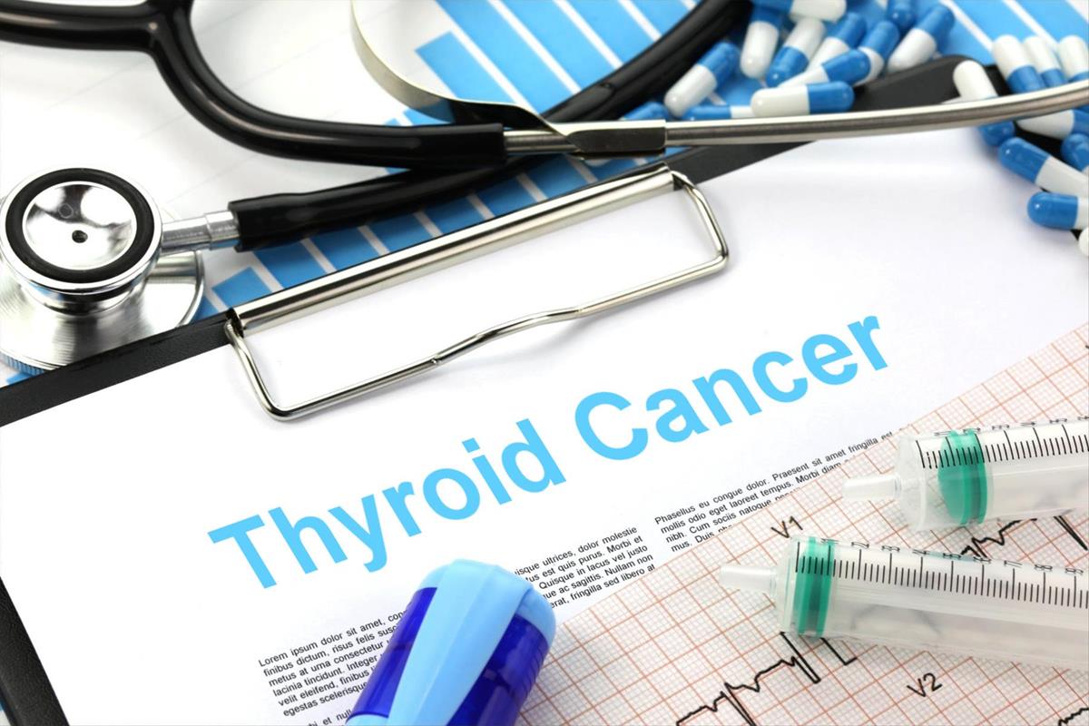 Read more about the article Thyroid Cancer: Understanding the Silent Killer